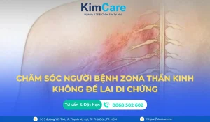 Chăm sóc người bệnh Zona thần kinh